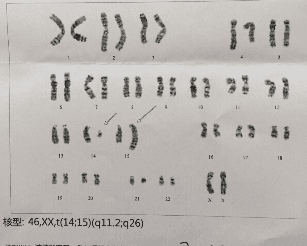 染色体+精子质量三大检查，男性孕前必查利器