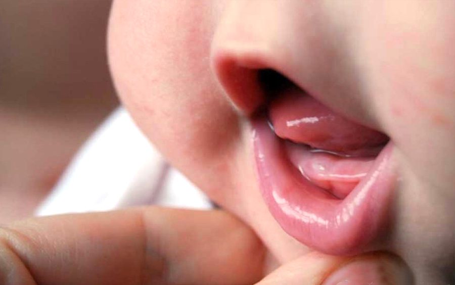 宝宝几个月长牙、出牙表现、应对建议，一文讲清，家长要正确护理