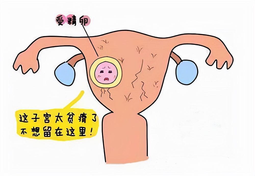 子宫内膜太薄的调理方法有这几种！你知道吗？
